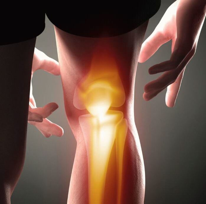 ¿Qué es la artritis y la artrosis